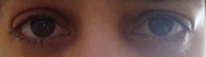 eyes1